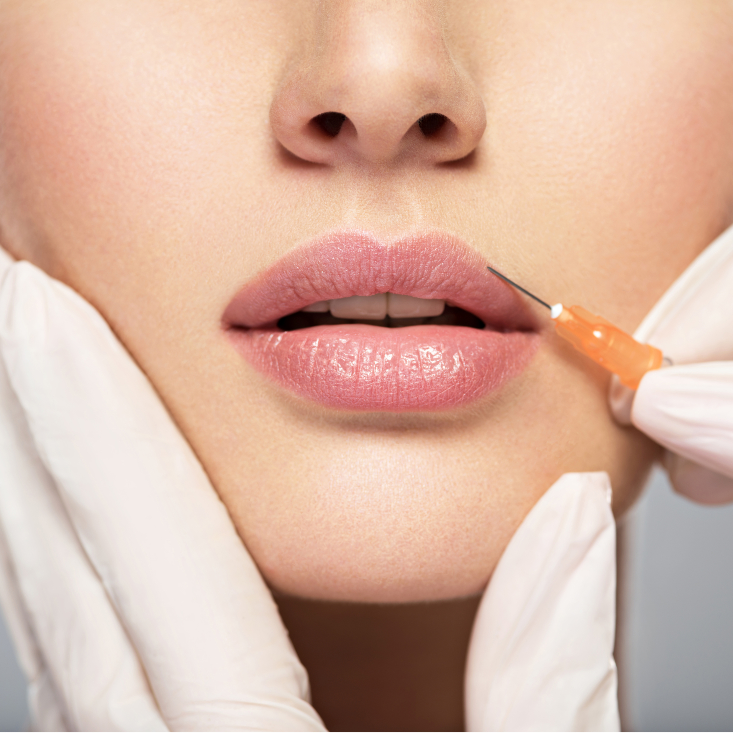 Tips to Reduce Lip Filler Swelling and Bruising | Elite Medical & Aesthetics | Lone Tree, CO 80124
