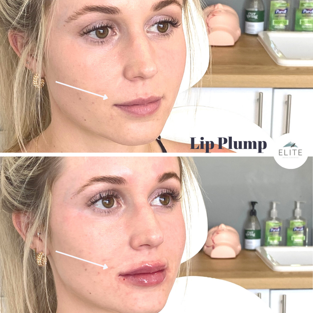 GLOW UP LIFT – Work Your Face